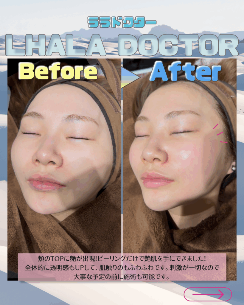 ?LHALA Doctor ?ビフォア＆アフター? | お知らせ | Credo Clinic